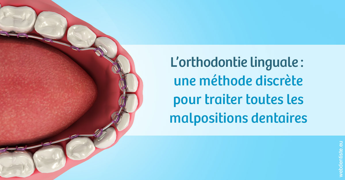 https://www.docteur-pauly-callot.fr/L'orthodontie linguale 1