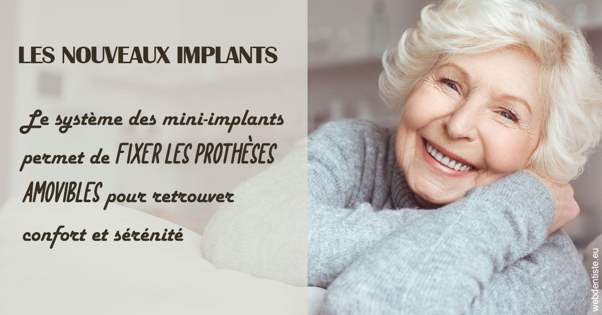 https://www.docteur-pauly-callot.fr/Les nouveaux implants 1