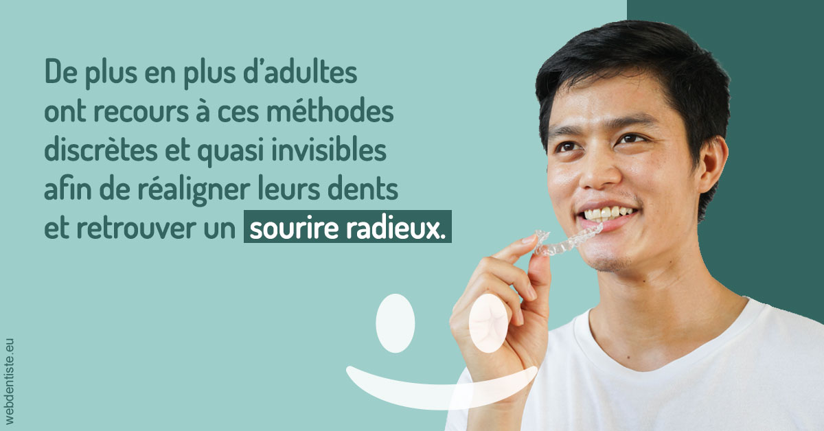 https://www.docteur-pauly-callot.fr/Gouttières sourire radieux 2