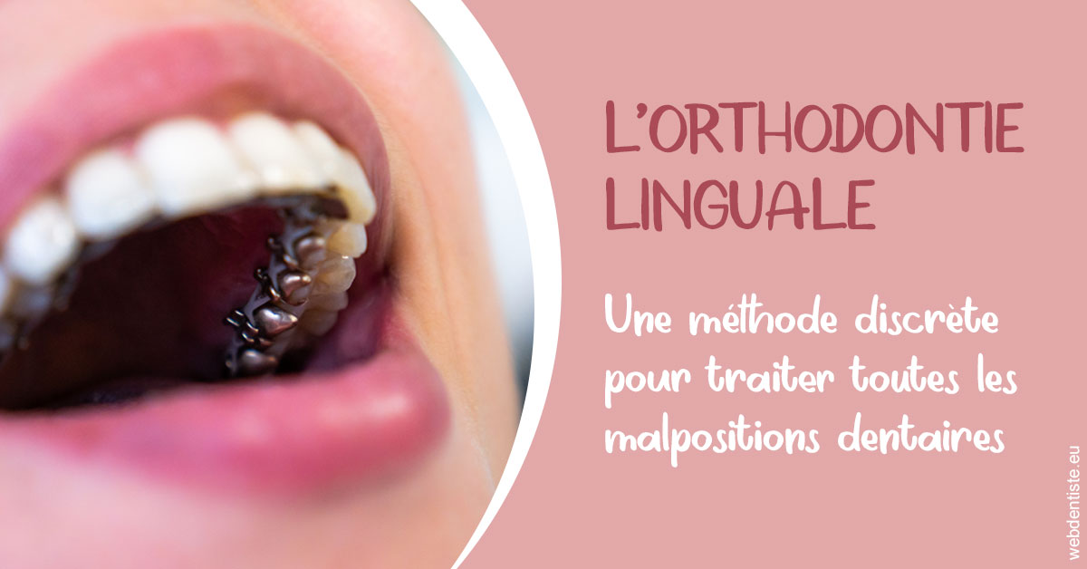 https://www.docteur-pauly-callot.fr/L'orthodontie linguale 2