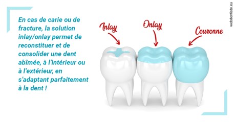 https://www.docteur-pauly-callot.fr/L'INLAY ou l'ONLAY