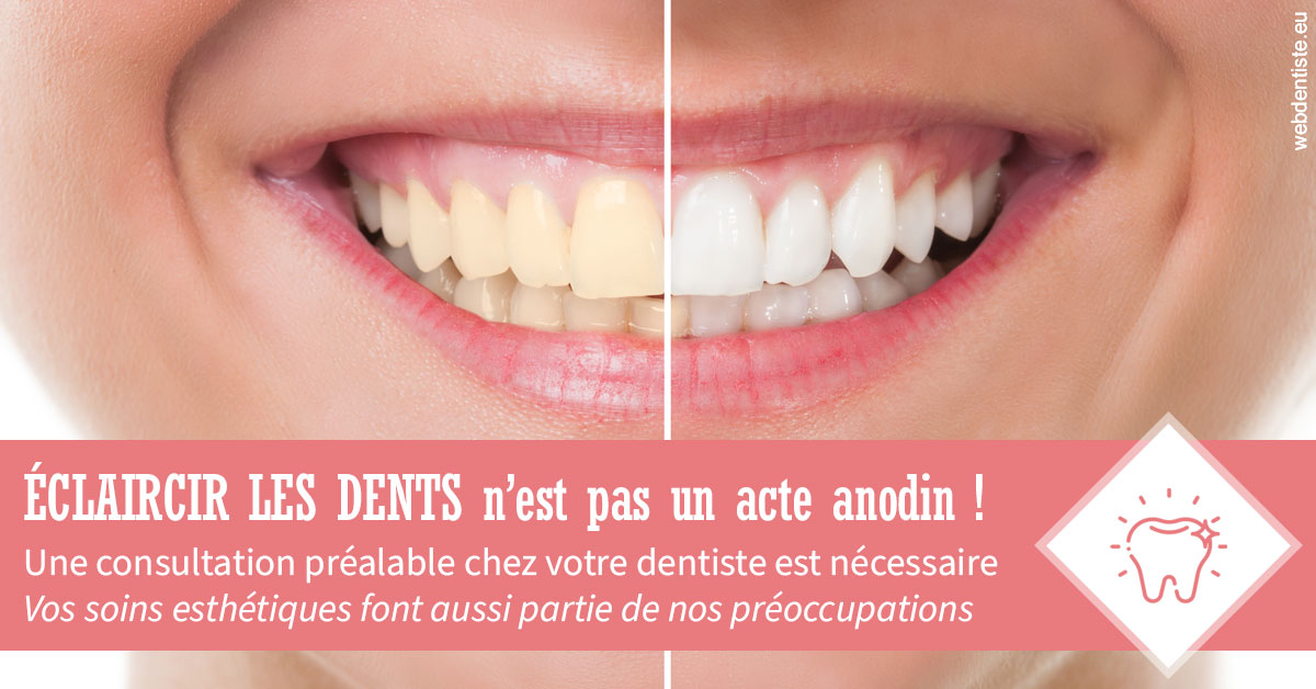 https://www.docteur-pauly-callot.fr/Eclaircir les dents 1