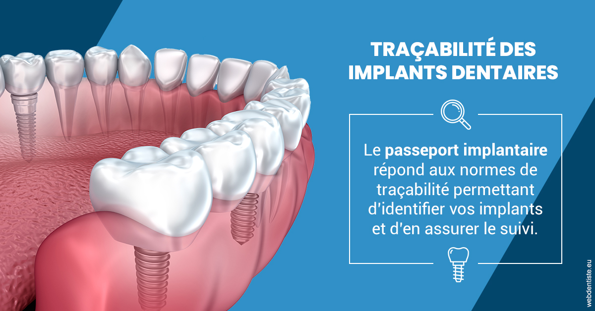 https://www.docteur-pauly-callot.fr/T2 2023 - Traçabilité des implants 1