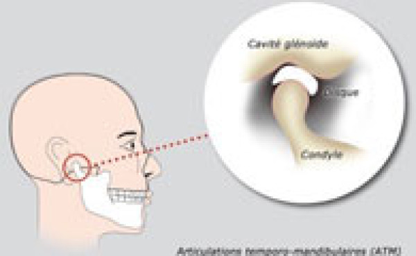 DAM et articulations temporo-mandibulaires (ATM)