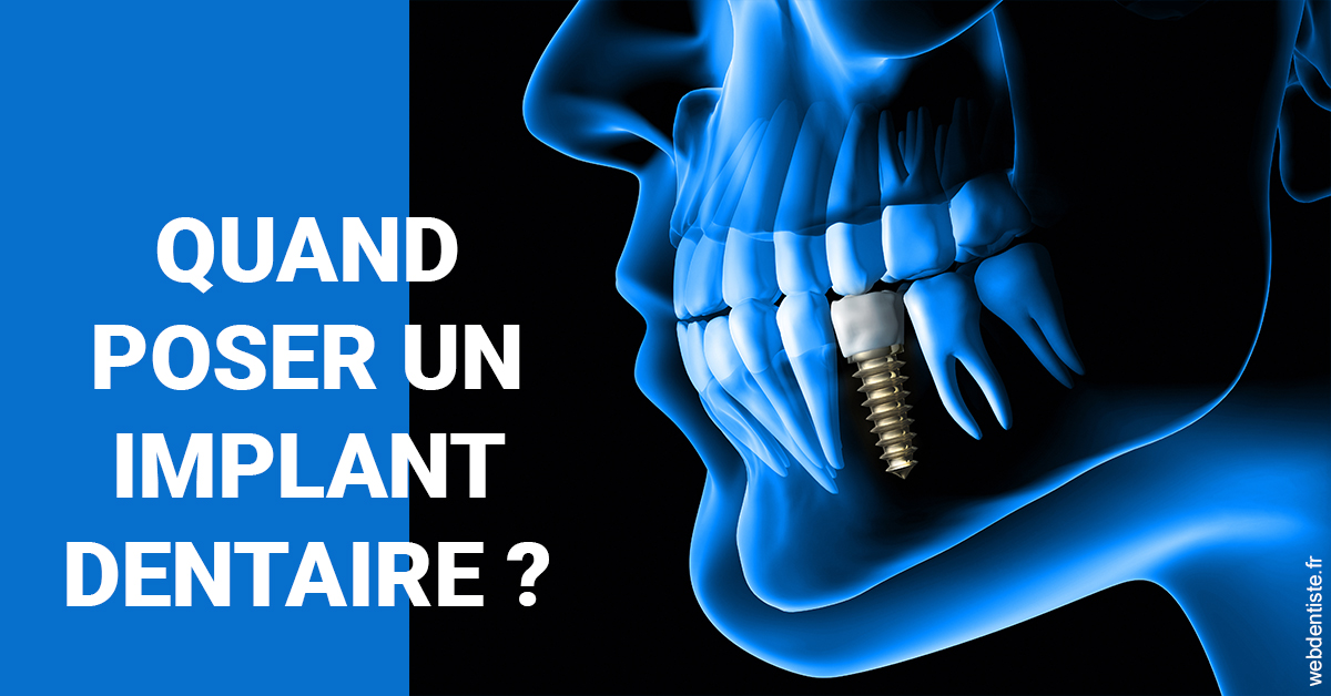https://www.docteur-pauly-callot.fr/Les implants 1