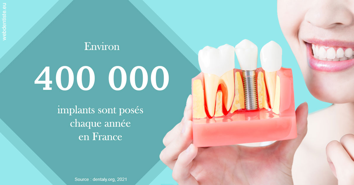 https://www.docteur-pauly-callot.fr/Pose d'implants en France 2