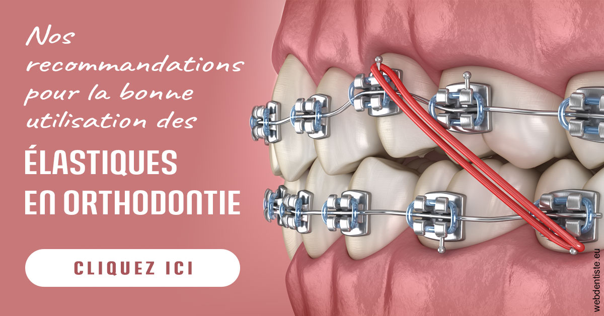 https://www.docteur-pauly-callot.fr/Elastiques orthodontie 2